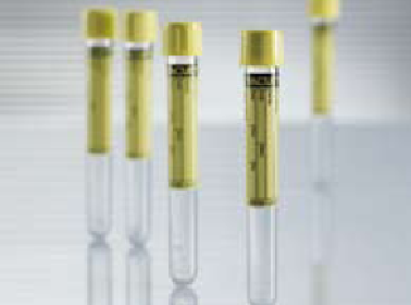 Vacuette® Urinalysis Tube, 9 mL, 16 x 100 mm